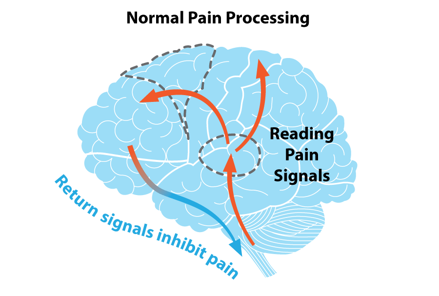 Music Therapy - blue colored image of brain with orange arrows in a circle