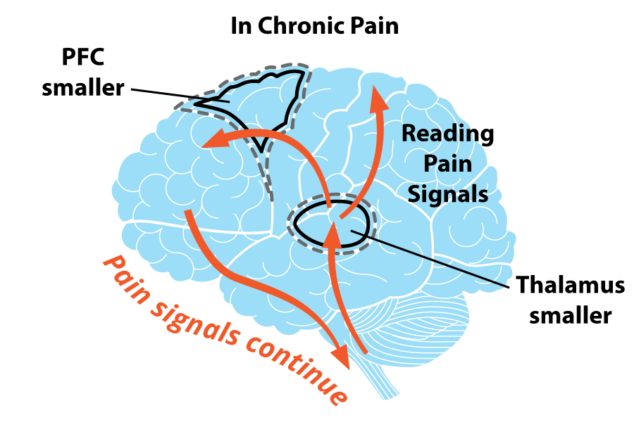 Music Therapy - blue colored image of brain with orange arrows in a circle