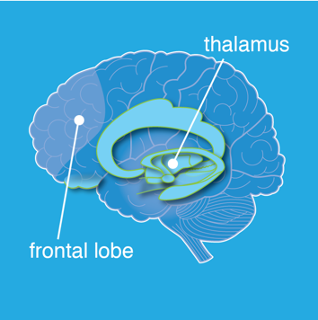 brain wave patterns - brain response to delta waves